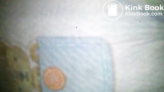 Diaper poop