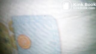 Diaper poop