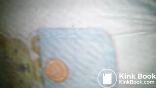 Diaper poop