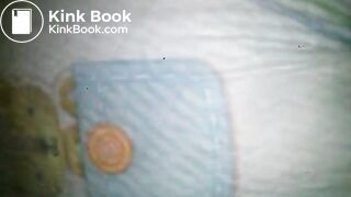 Diaper poop