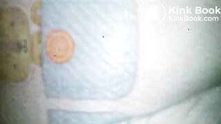 Diaper poop
