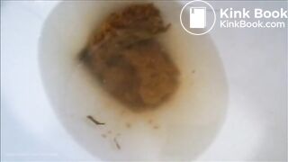 frontal view poop