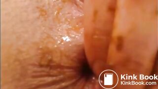 Scat 7