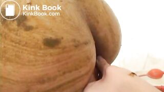 2 nurses lesbian scat part 2 of 2