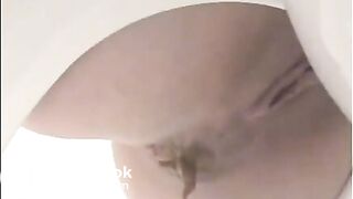 bowlcam diarrhea