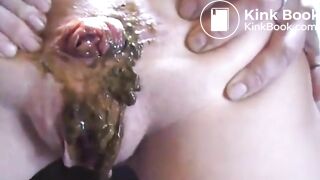 wet prolapse poop