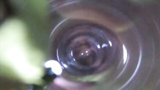 Observation　Inside Anus
