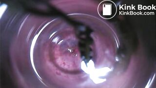 Observation　Inside Anus