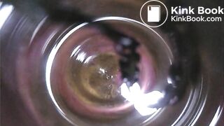 Observation　Inside Anus