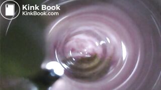 Observation　Inside Anus