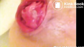 Anal Rosebud Poop Stuffing