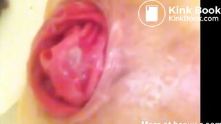 Anal Rosebud Poop Stuffing