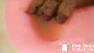 OPHMCUM0008