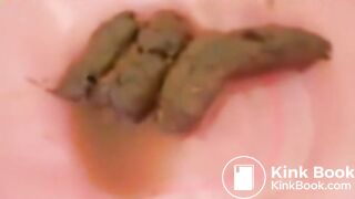 OPHMCUM0008