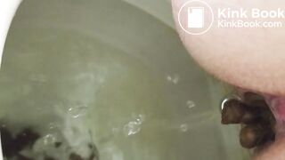 Emergency poop