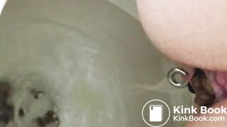 Emergency poop