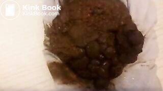 l poop