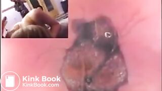 Russian girls get an inside view of their poop