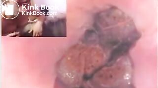 Russian girls get an inside view of their poop