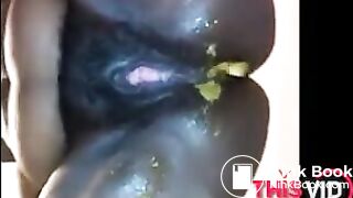 OPHMCUM0027
