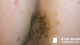 Irry fart and poop