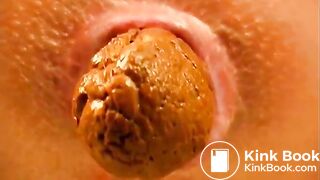 Closeup poo