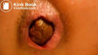 Closeup poo