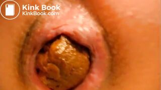 Closeup poo