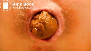 Closeup poo