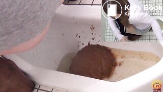 Liquid stool
