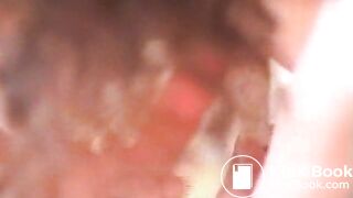 SC14-007505