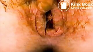0019