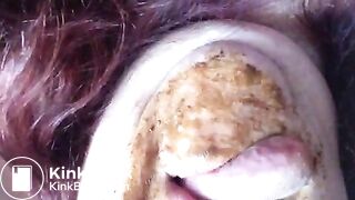 Scat