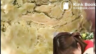 Anus cam