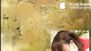 Anus cam