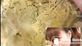 Anus cam