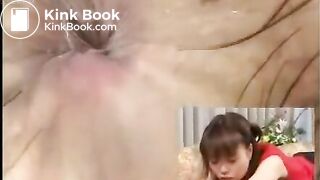 Anus cam