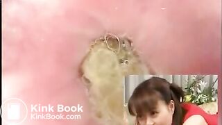 Anus cam