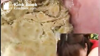 Anus cam