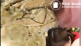 Anus cam