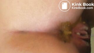 diarrhoea girl