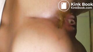 diarrhoea girl
