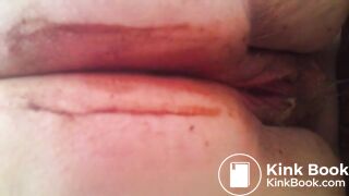 Pooping Scat tube video Scat porn Best Porn Tube Pooping gir-1