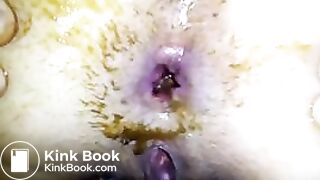 SCAT_ANAL_RITA 30