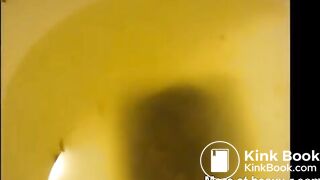 OPHMCUM0015