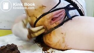 speculum