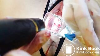 speculum