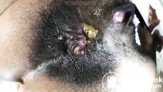 KITTY CATHERINE'S BLACK DIRTY ASS HOLE