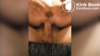 6617433