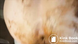 SCAT Anal